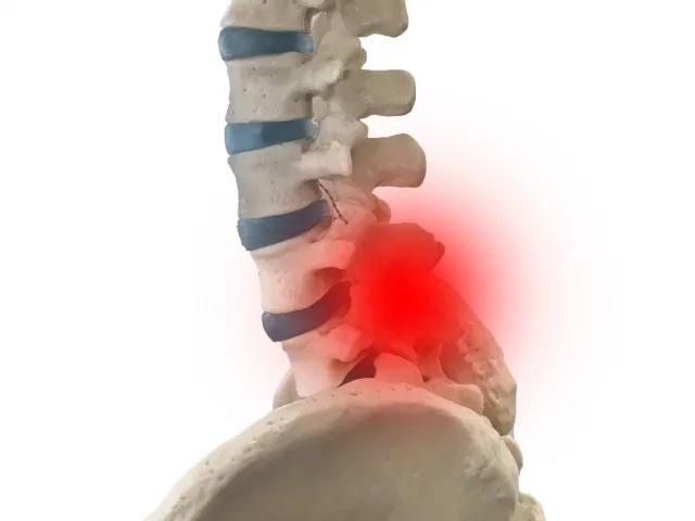 腰の骨模型