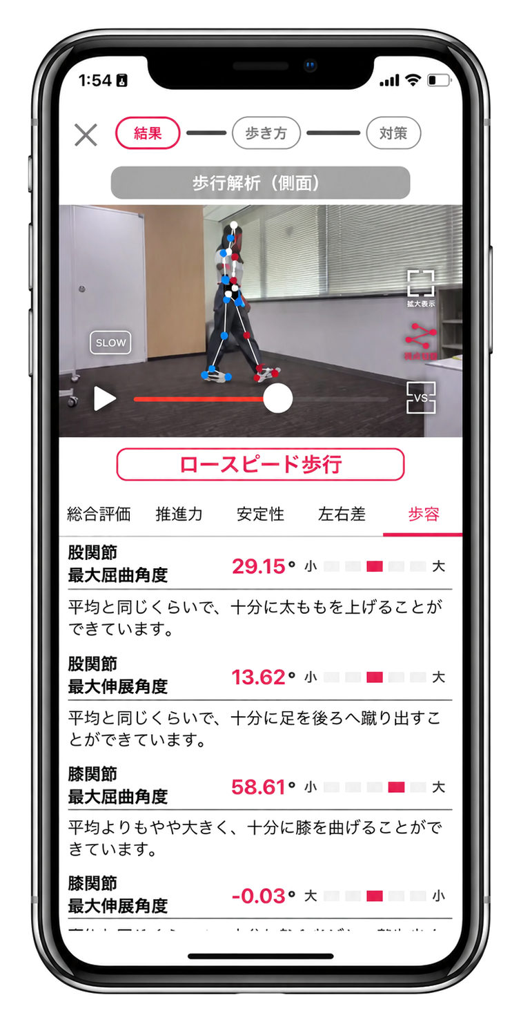 歩行解析 結果画面 — 股関節・膝関節の可動域スコア