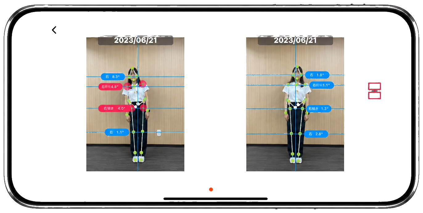 Before / After 比較 — 整体施術による姿勢改善の変化